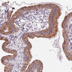 PIGA Antibody, Novus Biologicals:Antibodies:Primary Antibodies